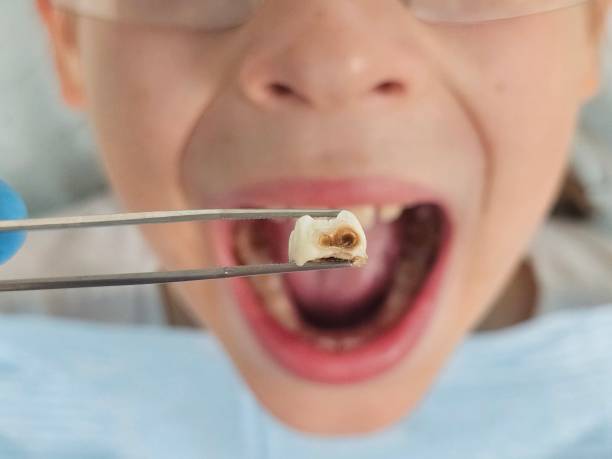 Best Emergency Dental Care for Trauma or Injury in Herculaneum, MO